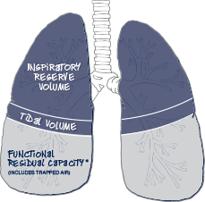 Lung capacity demonstrating inspiratory reserve volume, tidal volume, and functional residual capacity (which includes trapped air). Lung capacity demonstrating inspiratory reserve volume, tidal volume, and functional residual capacity (which includes trapped air).